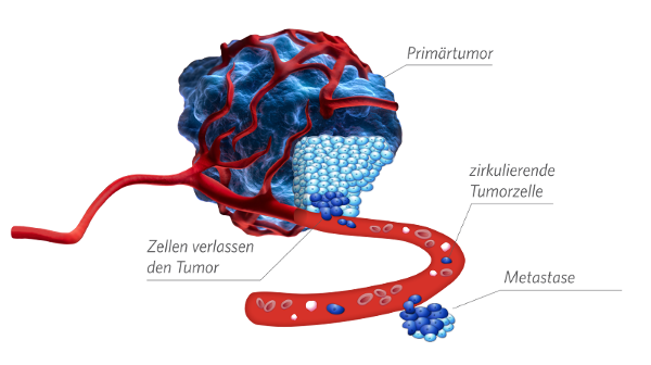 Krebs-Therapien-Tumor und zirkulierende Tumorzellen im Blut